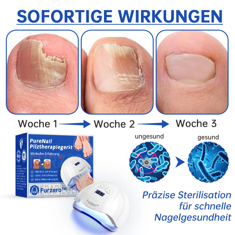 NailCure™ – Der sanfte Laser gegen Nagelpilz!
