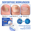 NailCure™ – Der sanfte Laser gegen Nagelpilz!