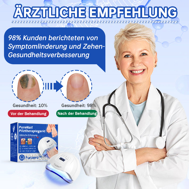 NailCure™ – Der sanfte Laser gegen Nagelpilz!