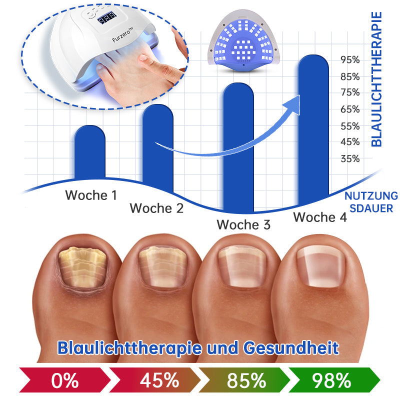 NailCure™ – Der sanfte Laser gegen Nagelpilz!