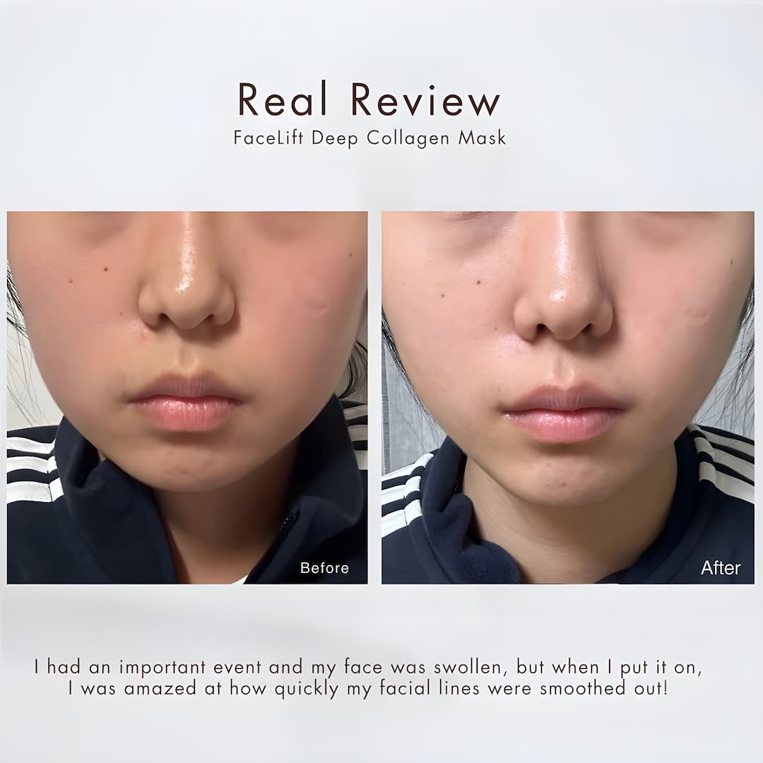 VisageLift™ – Deine natürliche 30-Minuten-Facelift-Maske ohne Nadeln & OP