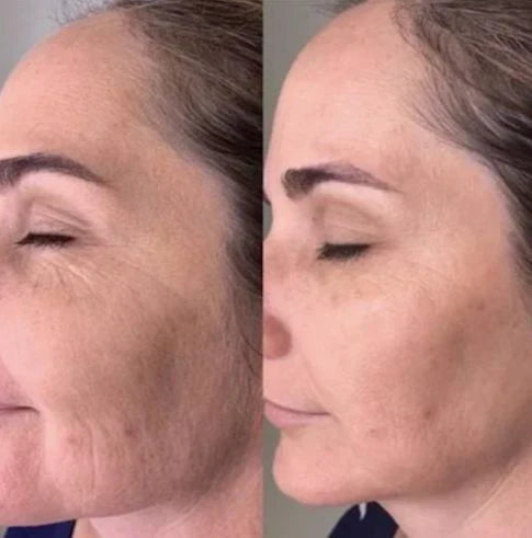 GlowingSkin™ – Dein LED-Lichttherapie-Masker für strahlende Haut ohne teure Behandlungen