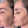 GlowingSkin™ – Dein LED-Lichttherapie-Masker für strahlende Haut ohne teure Behandlungen