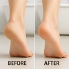 VelvetFoot™ | Mühelos glatte und gepflegte Füße