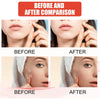 SmoothSkin™ – Die Revolutionären Haut-Patches für eine Perfekt Glatte Haut