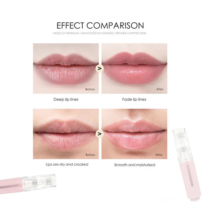 Derma Roller mit Serum-Applikator für Frauen | Für strahlende Haut & Lippenpflege