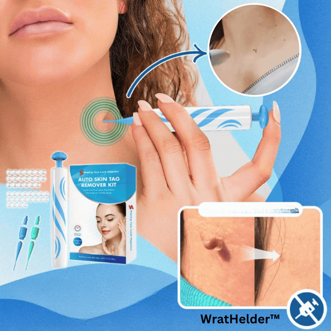 WartAway™ – Die schmerzfreie Lösung zur effektiven Warzenentfernung