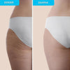 SkinSculpt Pro™ – Straffungs- & Anti-Cellulite-Massagegerät