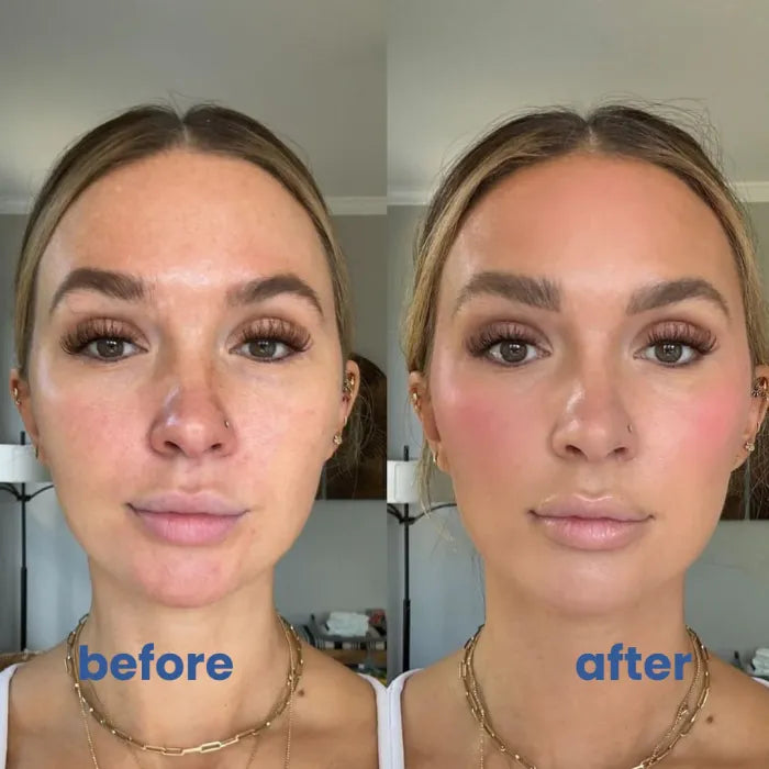 SkinMischung™ – Die Sofortige Lösung gegen Hautrötungen und Irritationen