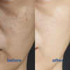 SkinMischung™ – Die Sofortige Lösung gegen Hautrötungen und Irritationen