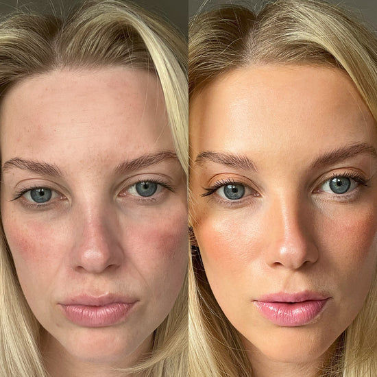 GlowingSkin™ – Dein LED-Lichttherapie-Masker für strahlende Haut ohne teure Behandlungen